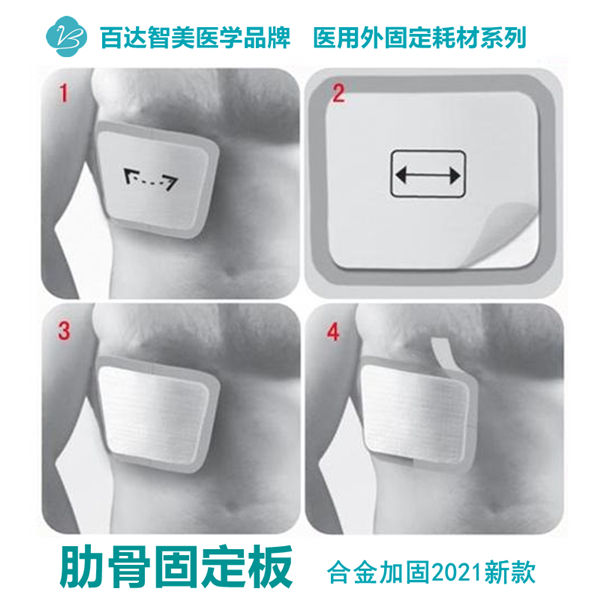 1770090142329465.jpg 百达智美医学肋骨固定板_副本_副本.jpg